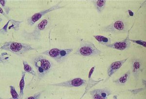 Хламидиоз – это заболевание, которое вызывается простейшими микроорганизмами – хламидиями