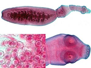 Эхинококк – это ленточный червь длиной около 5 мм, имеющий сколекс с присосками и короной, шейку и членики