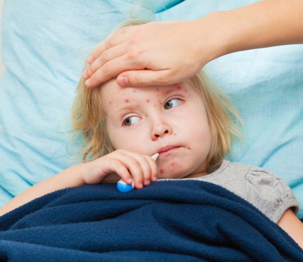 Сила иммунитета влияет на протекание кори у детей, симптомы и формы заболевания