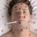 Symptoms of measles in adults – how to move “nursery” disease