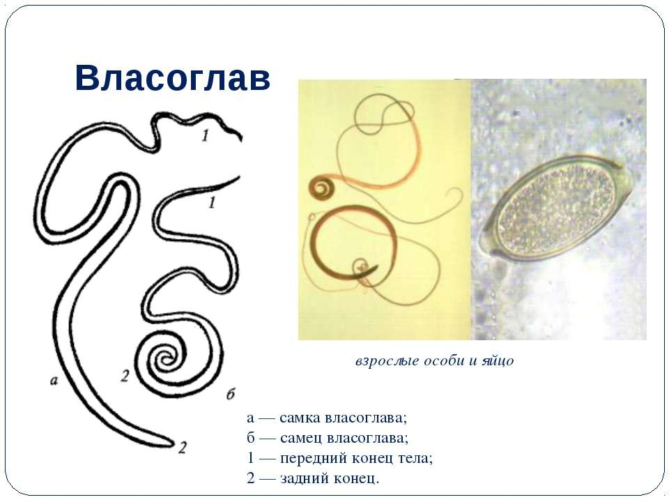 Власоглав - возбудитель болезни