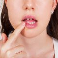 Як швидко і ефективно вилікувати герпес на губах?