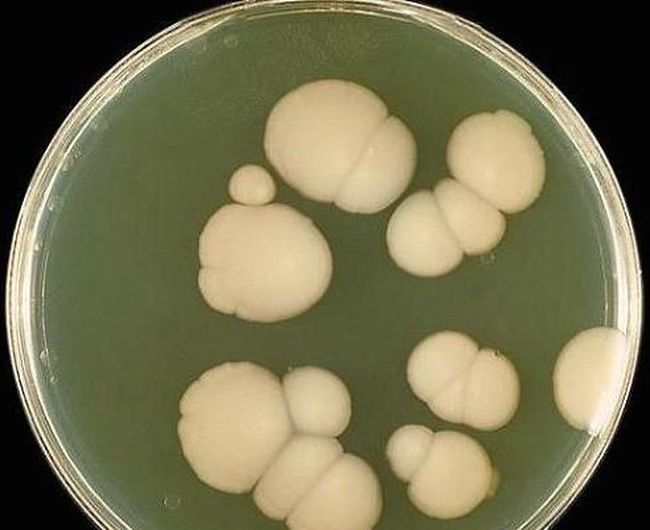 Кандидоз, или молочница – заболевание, вызванное грибком рода Candida