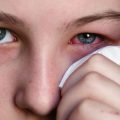 viral conjunctivitis – how to protect the eyes from injury?