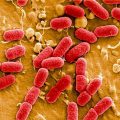 Indicator Escherichia coli in urine - what it means and what to do?