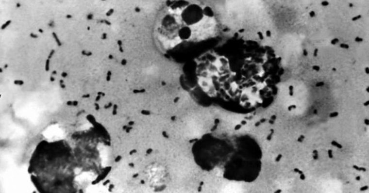 На фото показано, как выглядит под микроскопом бактерия чумы Бубонной - Yersinia Pestis.