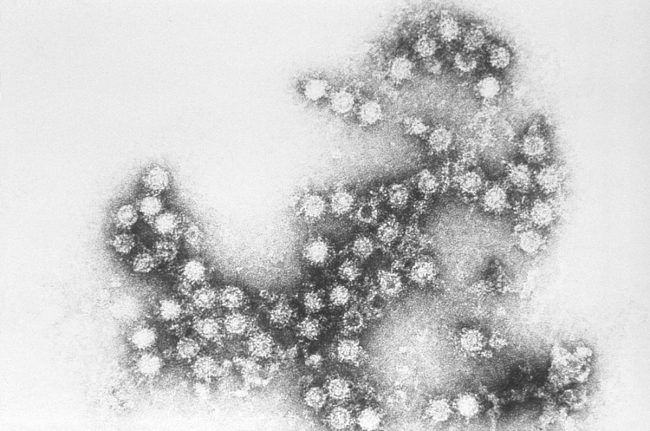 Вирус Коксаки относится к семейству энтеровирусов (кишечные вирусы). Он представляет собой РНК-содержащий вирус